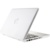 Fliku Protect Pro for MacBook Air 11 - фото 1