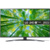 LG UQ81 43UQ81006LB - фото 1